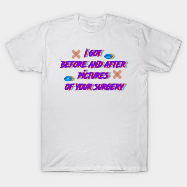 I got  before and after  pictures  of your surgery T-Shirt by LanaBanana